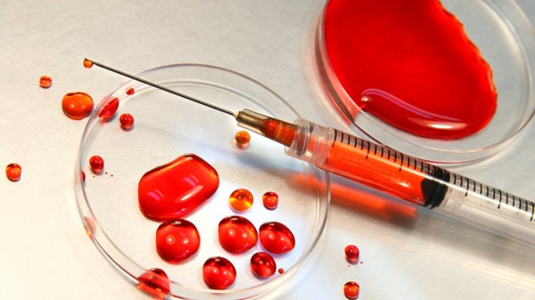 Российские ученые разработали высокоточную систему анализа крови