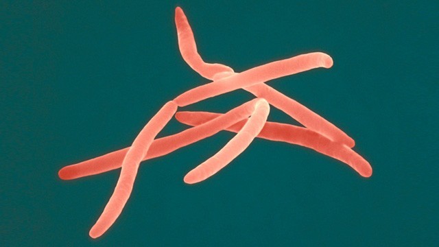 Ученые: Бактерии из ротовой полости провоцируют рак