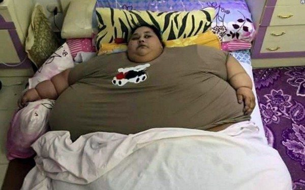 Самая толстая женщина в мире попросила помощи