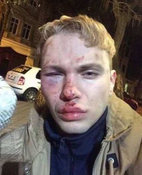 Ученика Ивана Дорна избили и ограбили в Одессе