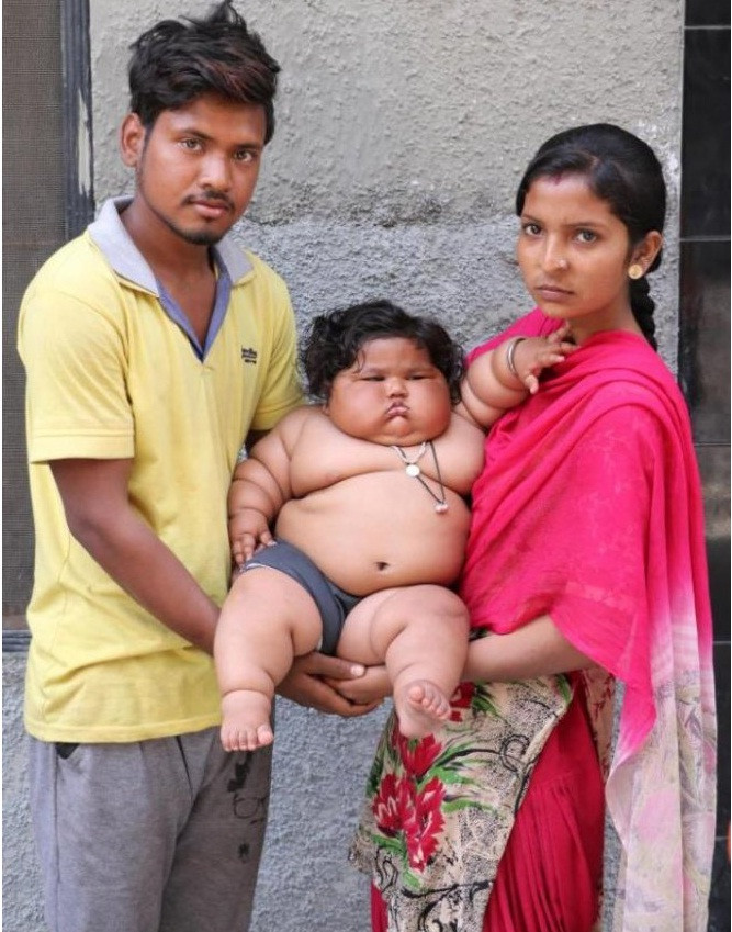 В Индии 8-месячная девочка весит 17 килограмм