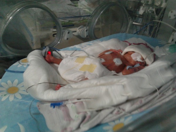На Кубани медики выходили за пять лет 800 недоношенных младенцев