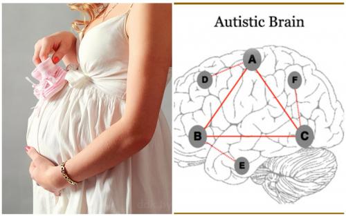 Причина аутизма - в матери: Гормон плаценты может привести к отклонению – медики