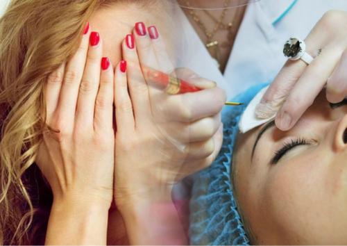 Шрамы и «лысая» бровь: Нижегородский бровист испоганил лицо россиянки микроблейдингом